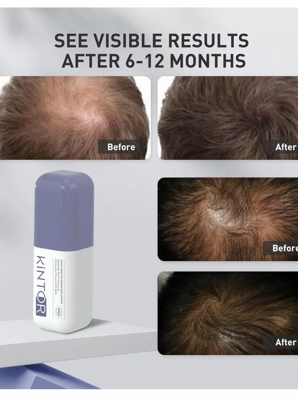 KINTOR Hair Growth Foam Spray for Men 60ml / 2 fl oz #035
